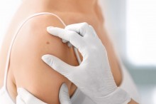 Anyajegy-és bőrrákszűrés