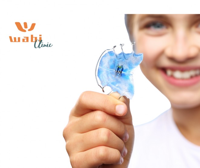 Gyermekfogszabályozás