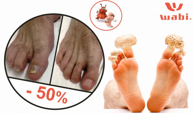 Egészséges körmök most akár 50% kedvezménnyel